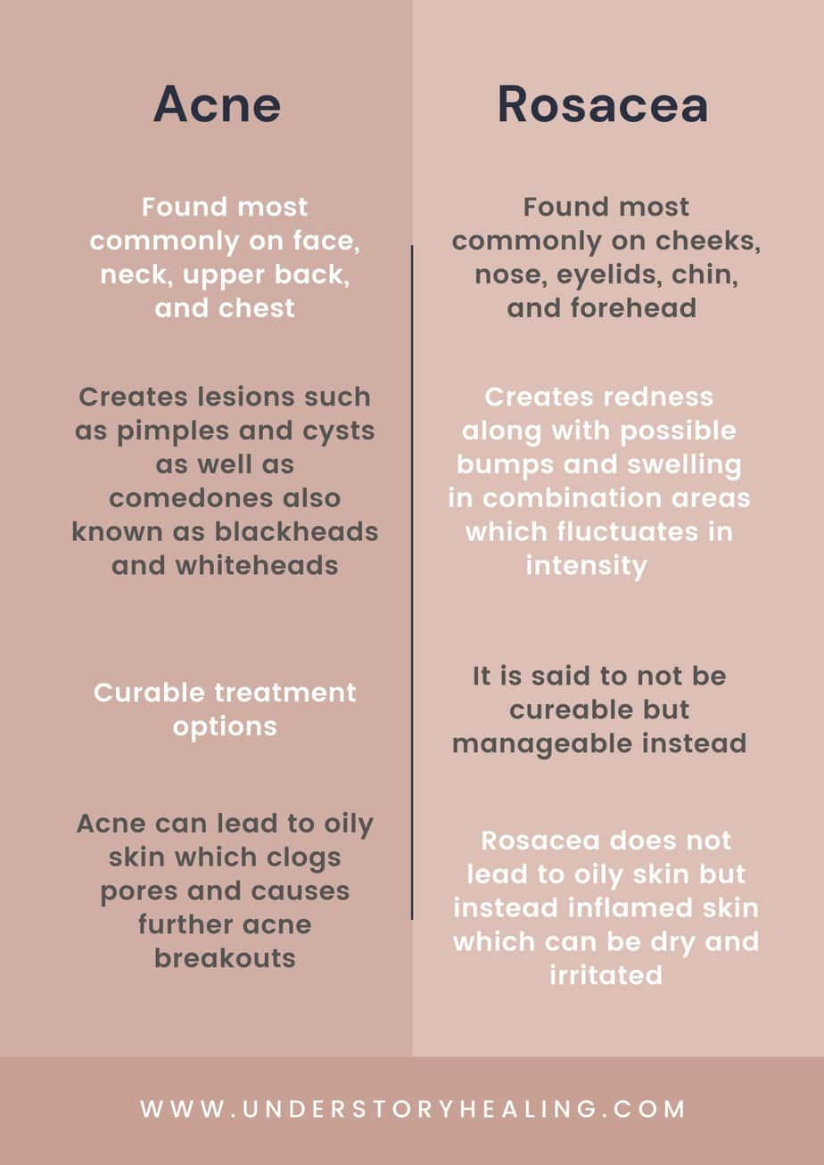 Acne Vs Rosacea Infograph